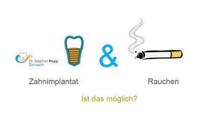 Zahnimplantat Rauchen