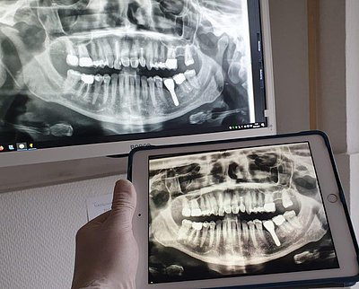 OP'G Röntgen Zahnarzt