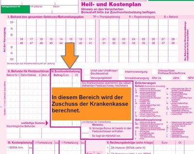 Festzuschuss Zahnersatz von der Krankenkasse