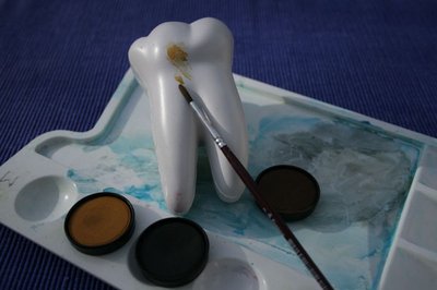 Verfärbungen Zähne Zahnhals