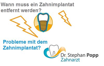 Probleme Zahnimplantat entfernen