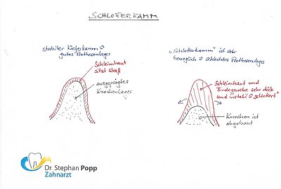 Schlotterkamm Zahnmedizin